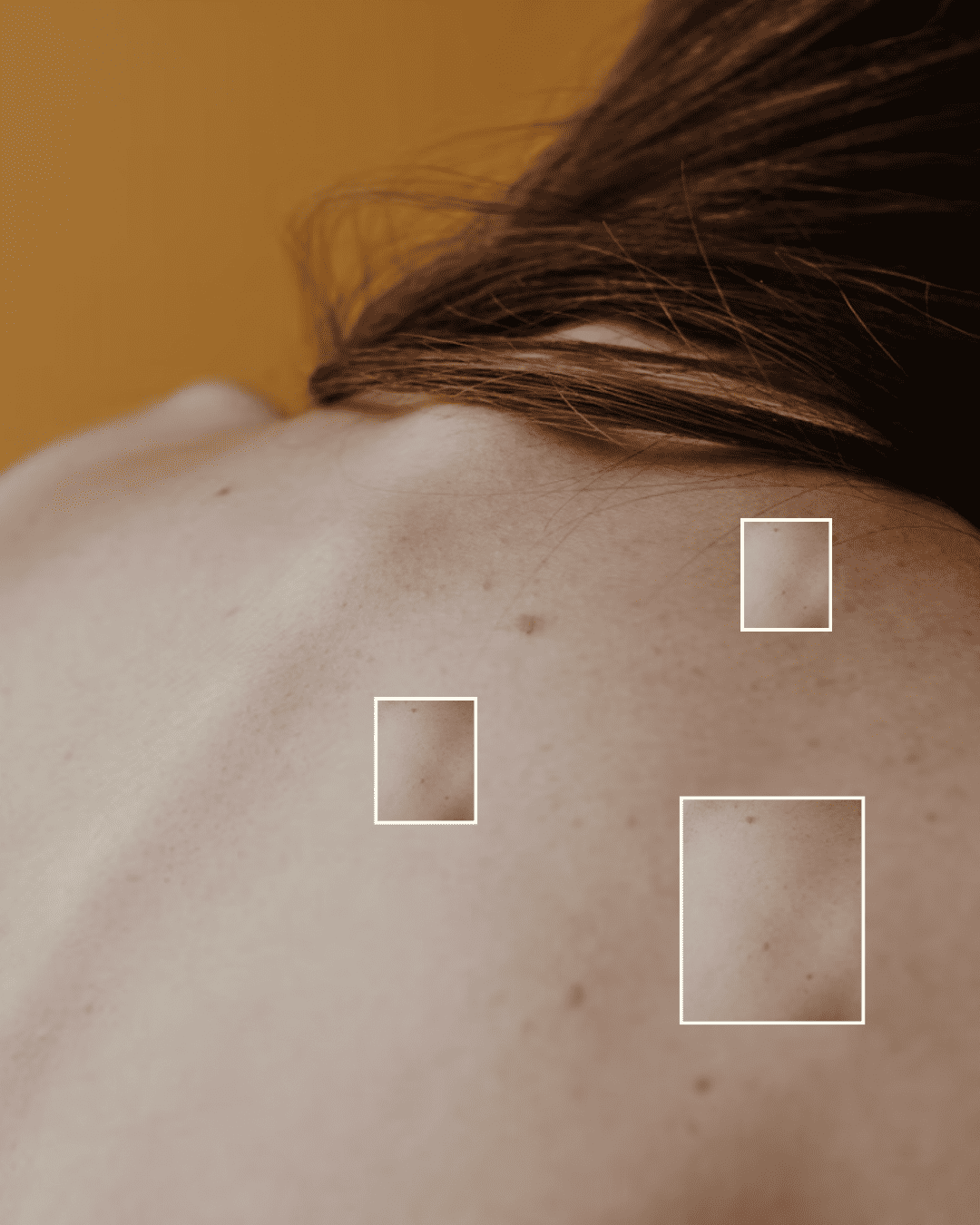 Το δέρμα μας μετά το καλοκαίρι.